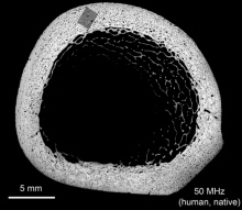 bone cross section 